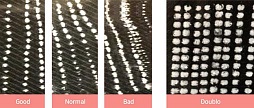 Coagulation bars during <i>HIFU</i> therapy