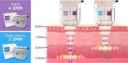 Optimized cartridges for specific regions